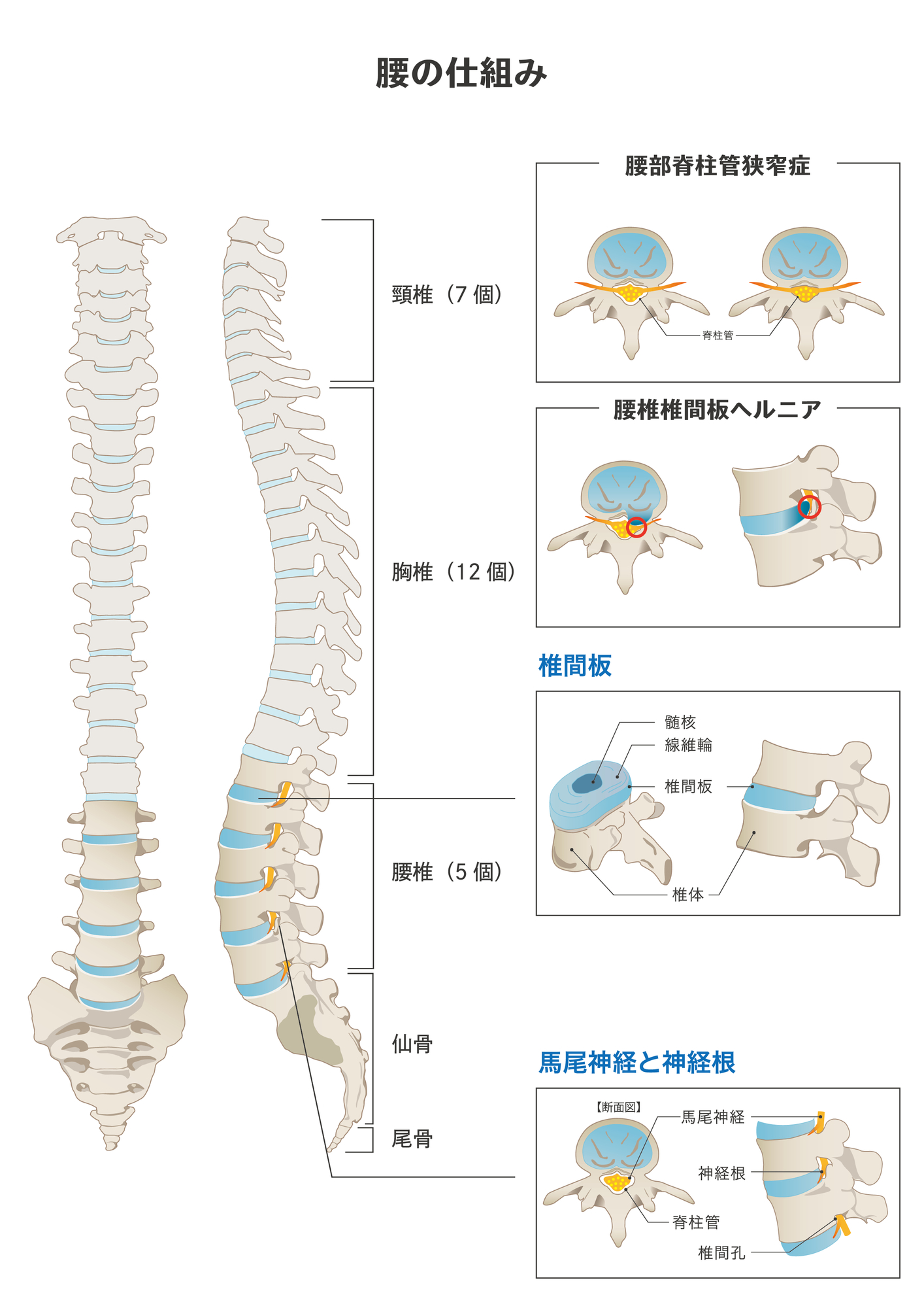 脊柱管狭窄 腰部 手術の種類 一覧とメリット デメリット セカンドオピニオン Com